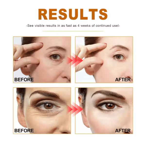 West&Month Tiktok Hot Selling Skin Barrier Repairing Deep Wrinkles and Dark Spots Erasing Elastic Skin Getting Serum - Image 4