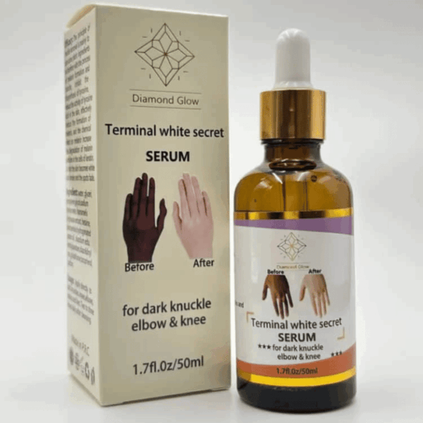 Dark Knuckles Fast Whitening Serum – Pigmentation Corrector for Hands, Elbows, Knees & Feet | 50ml | Vitamin C, Niacinamide, Collagen | Intense Stain Remover