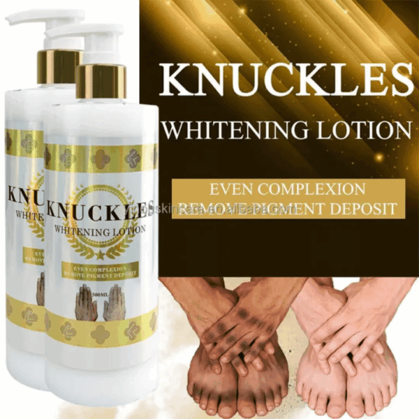 Gluta Booster Knuckles Whitening Body Lotion – 500ml | Brightens Feet, Elbows & Knees | Smooths & Evens Complexion | Tranexamic Acid + Vitamin C | OEM/ODM