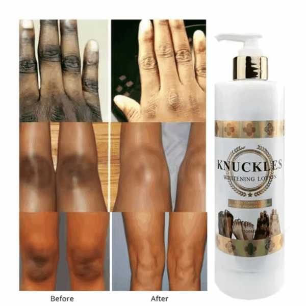 Gluta Booster Knuckles Whitening Body Lotion – 500ml | Brightens Feet, Elbows & Knees | Smooths & Evens Complexion | Tranexamic Acid + Vitamin C | OEM/ODM - Image 4