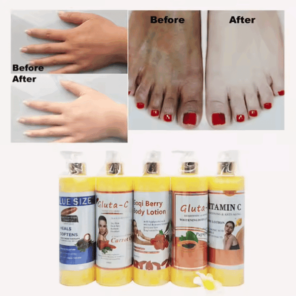 Custom Logo Gluta Vitamin C Collagen Body Whitening Lotion – 500ml | No Side Effects | Brightening, Spot Removal, Knuckle Lightening | OEM/ODM Private Label