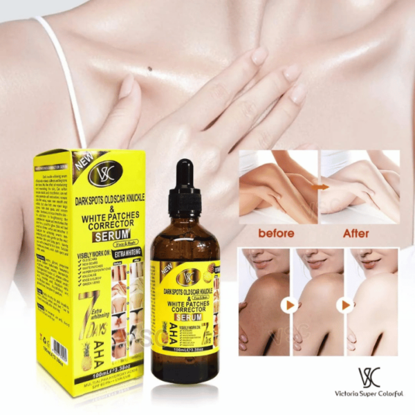 High Quality 7-Day Pineapple Repair Serum – Dark Spot, Scar, Knuckle & White Patch Corrector - Image 2
