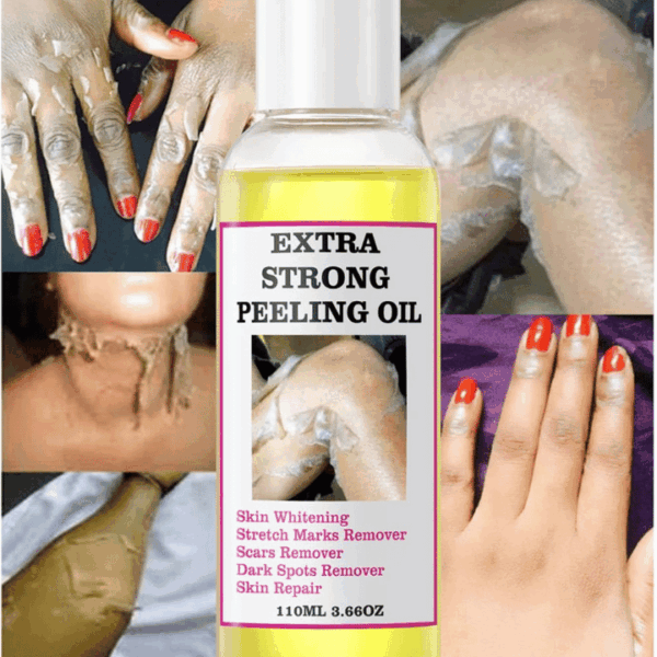 3PC Yellow Peeling Oil,Peeling Oil,Exfoliating Peeling Solution for Body All Skin Type Dead Skin Remover