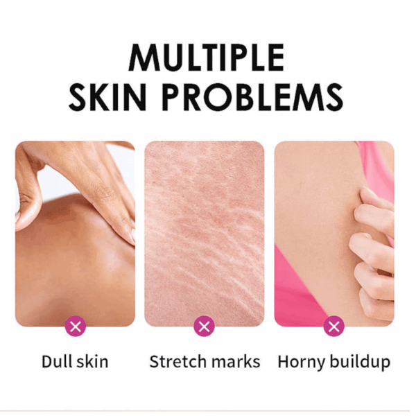 3PC Yellow Peeling Oil,Peeling Oil,Exfoliating Peeling Solution for Body All Skin Type Dead Skin Remover - Image 4