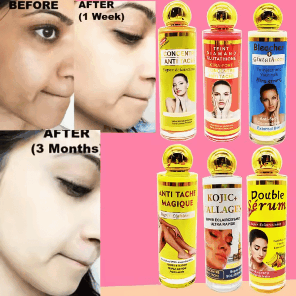 Six Kinds of Series Serum – Whitening, Lightening, Anti-Aging & Anti-Tache Skin Care Serum with Collagen, Coconut Oil & Vitamin C - Image 2