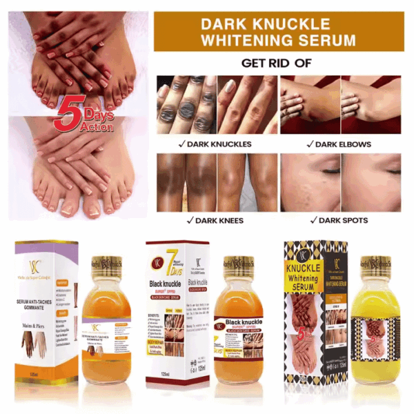 Turmeric Arbutin Whitening & Repairing Essence – Kojic Acid Brightening & Moisturizing Liquid Serum for Face & Body – 125ml - Image 4