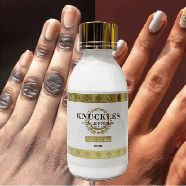Extreme Lightening Serum – Dark Knuckles Remover, Deep Moisturizing, Hyperpigmentation Inhibition - Image 2
