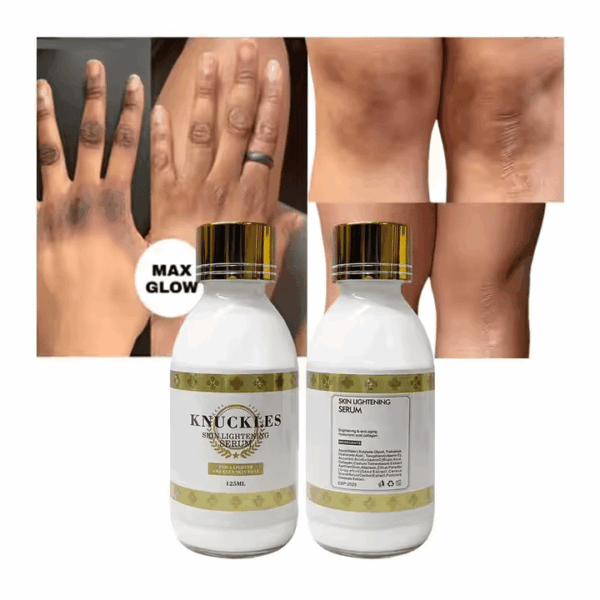 Extreme Lightening Serum – Dark Knuckles Remover, Deep Moisturizing, Hyperpigmentation Inhibition - Image 3